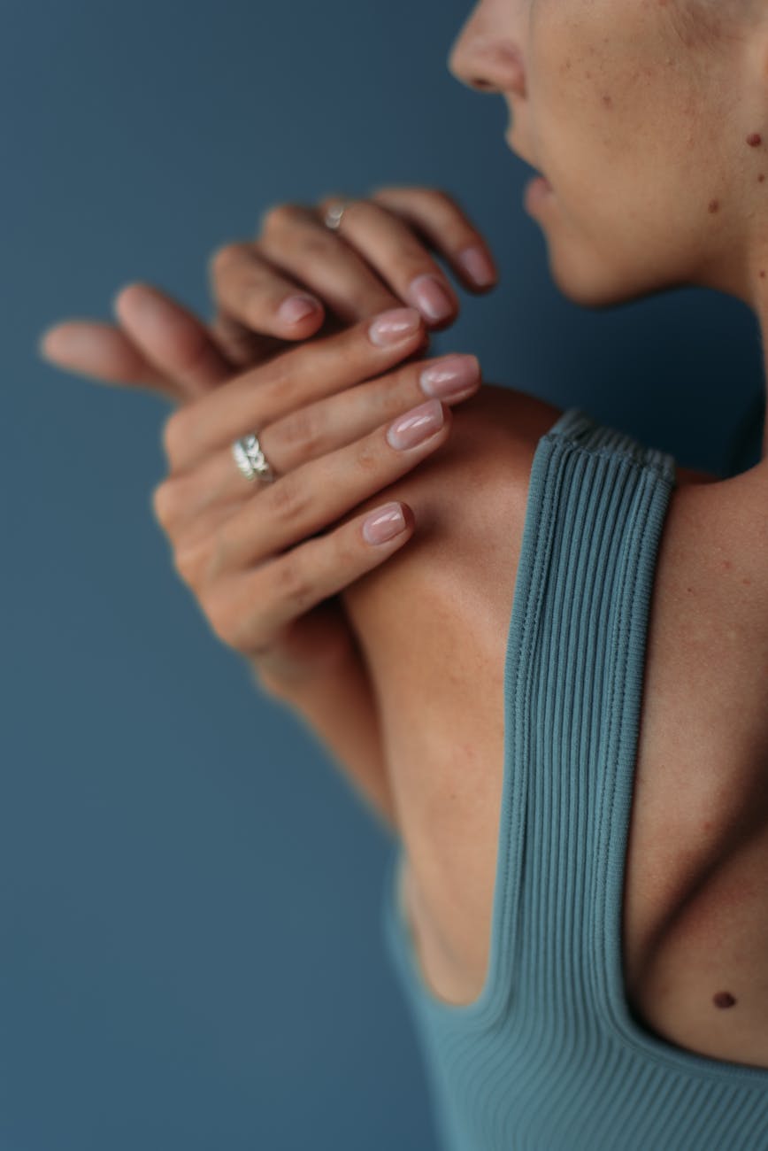 Hypermobility and Its Impact on the Upper&nbsp;Extremity